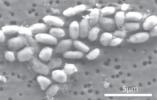 Illustration for article titled NASA's arsenic-life findings debunked in two just-published studies